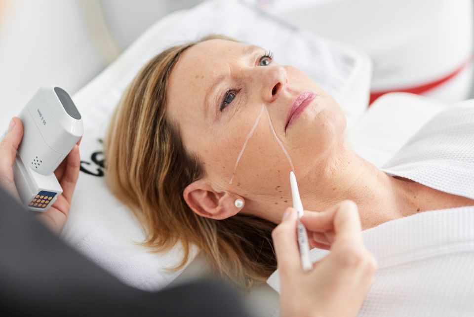 Hifu Behandeling Apollo Beauty Rotterdam 04