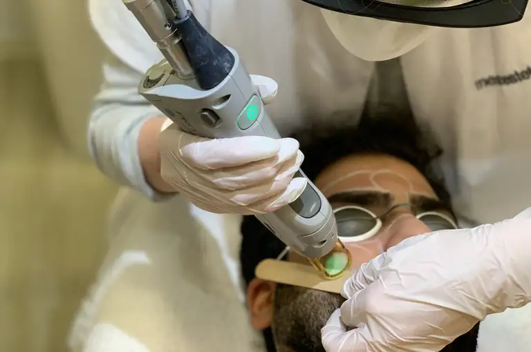Laserbehandeling door huidspecialist bij Apollo Beauty, erkend door zorgverzekeraars.