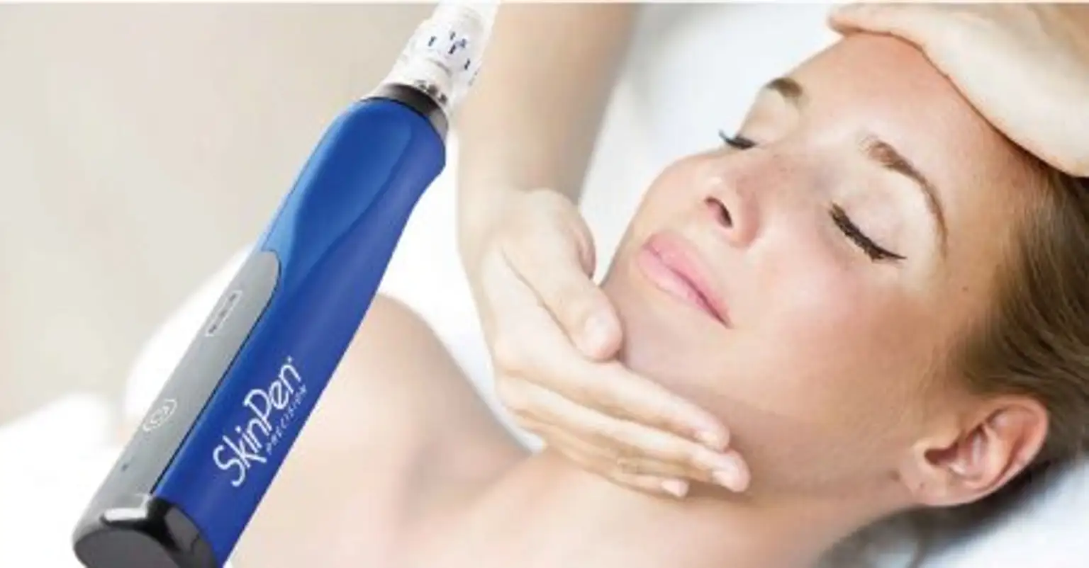 Vrouw ondergaat SkinPen medische microneedling behandeling voor huidverjonging en verbetering van de huidstructuur.