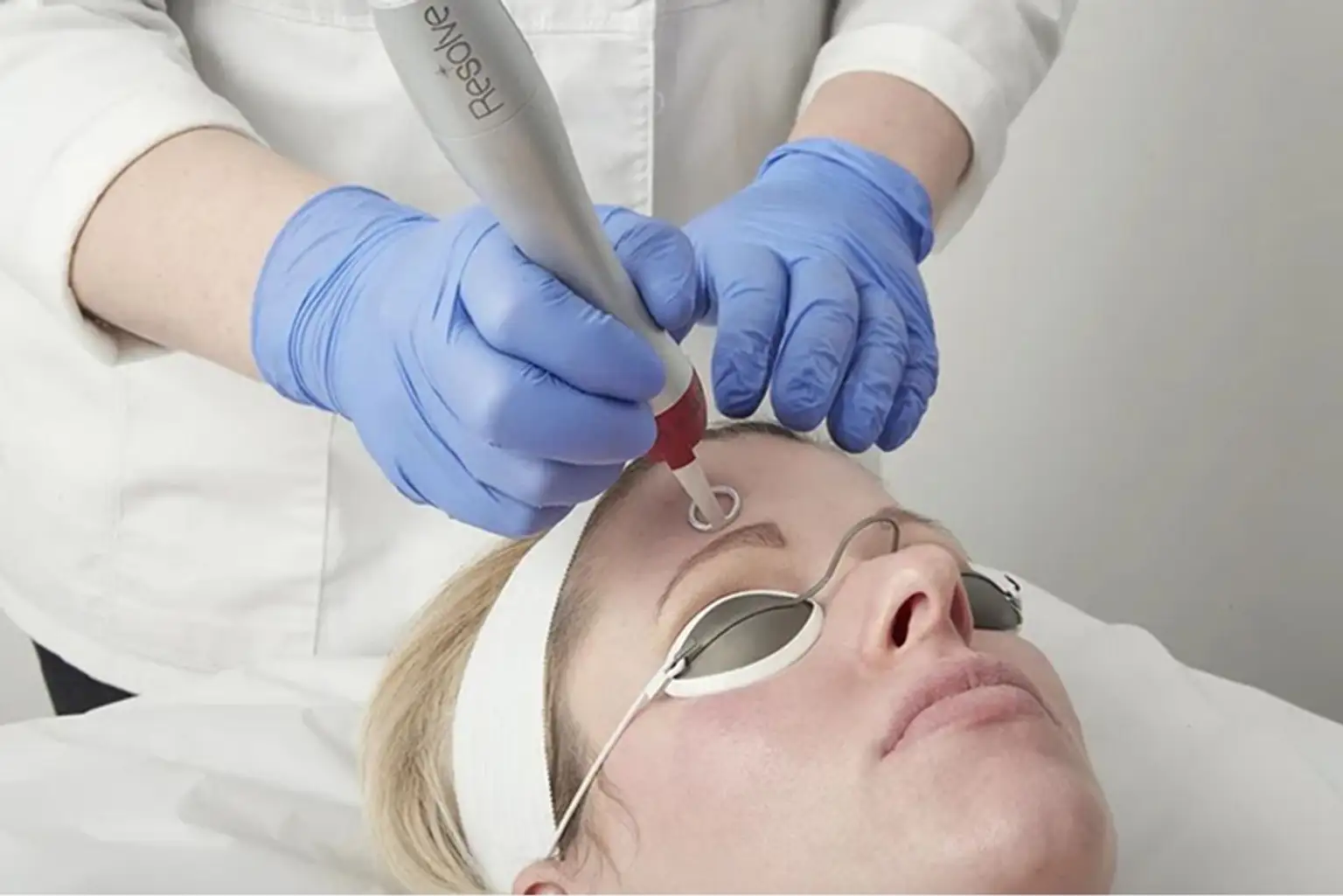 Pigmentvlekken, littekens & tattoo laten verwijderen in Rotterdam