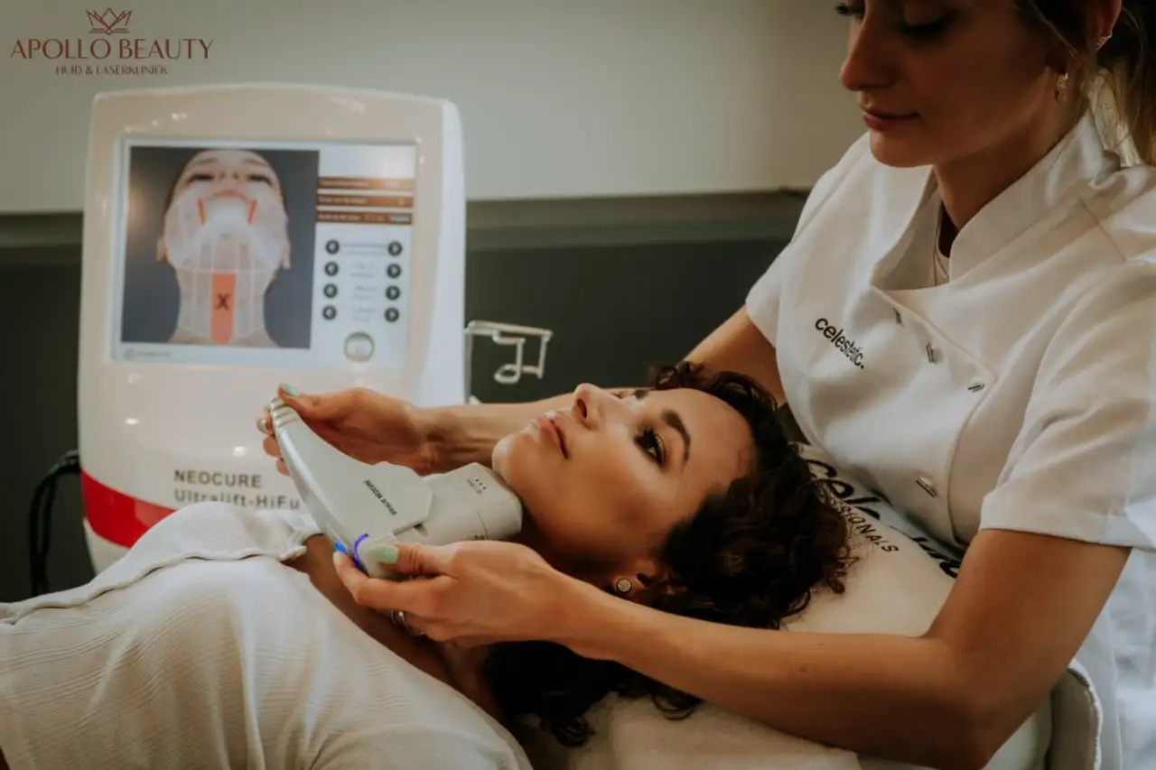 Huidtherapeut voert HIFU-behandeling uit voor huidverstrakking bij Apollo Beauty kliniek.