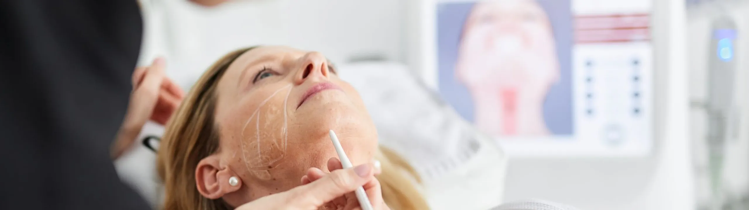 Huidtherapeut voert HIFU-behandeling uit voor huidverstrakking bij Apollo Beauty.