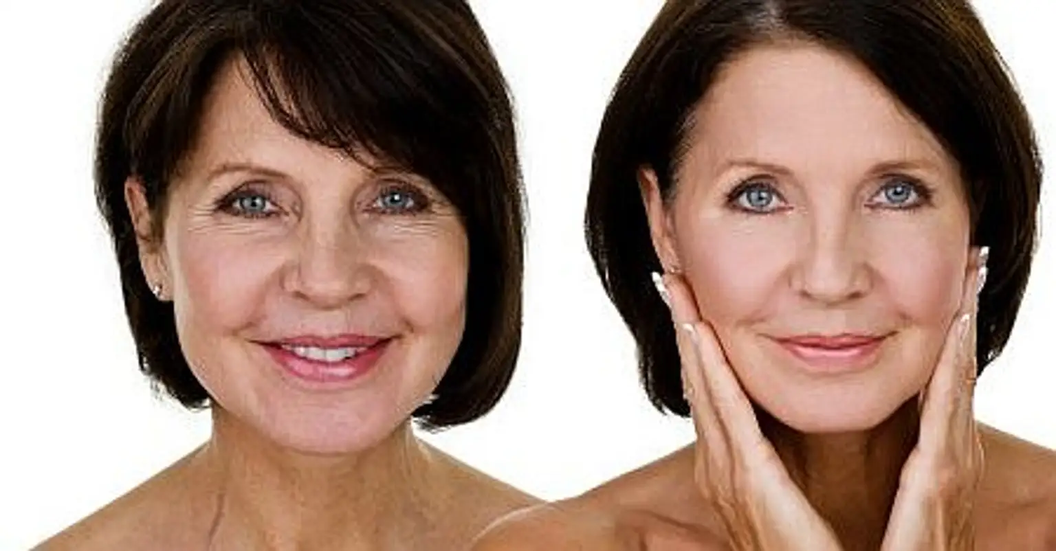 Voor en na resultaat van anti-aging gezichtsbehandeling: vrouw met zichtbaar gladdere en stralendere huid.
