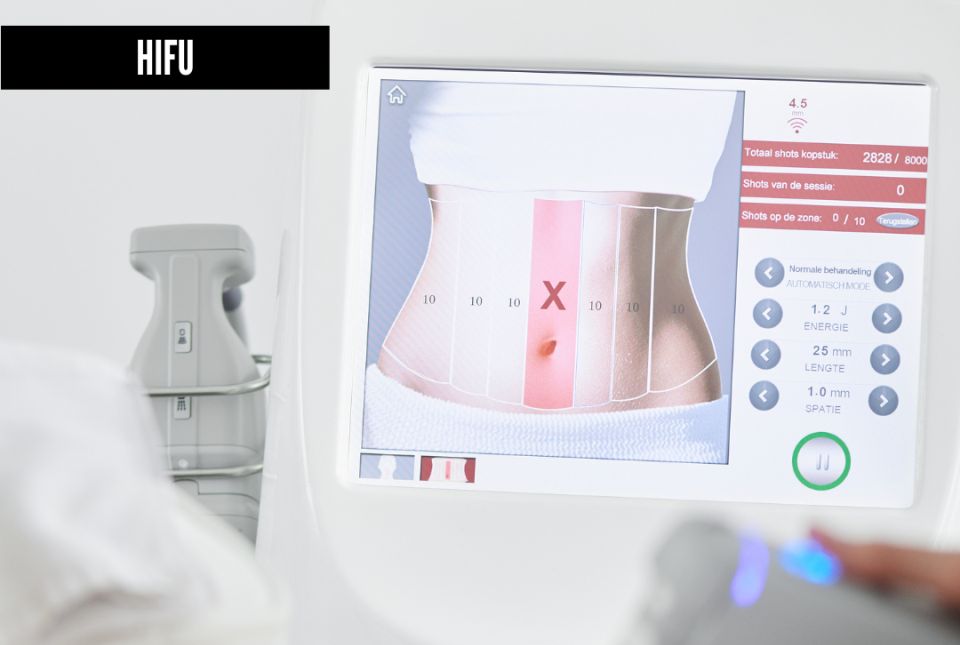 Hifu Behandeling Apollo Beauty Rotterdam 03