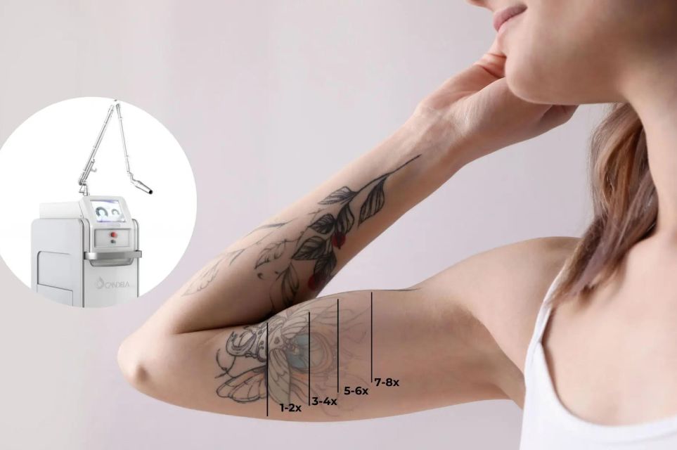 Prijzen Picoway laser behandelingen