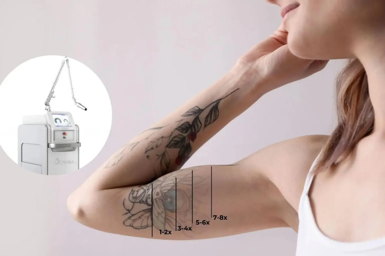 Prijzen Picoway laser behandelingen