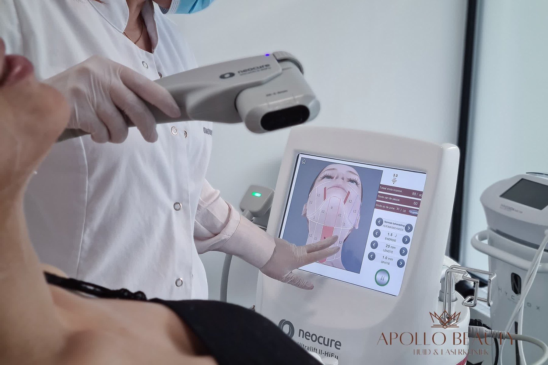 Apollo Hifu 5