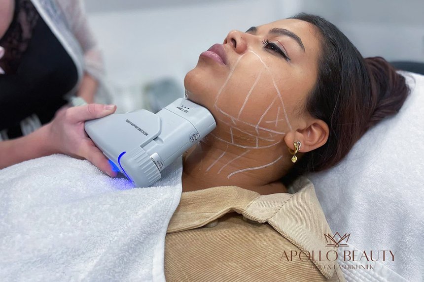 Hifu Huidverstrakking behandeling