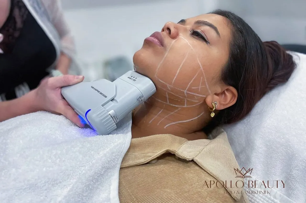 Hifu Huidverstrakking behandeling