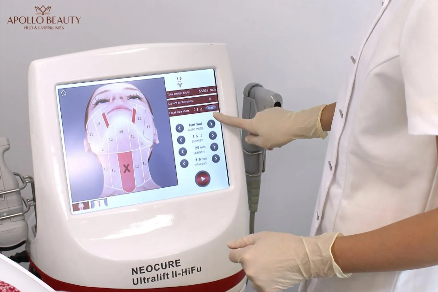 Huidtherapeut bereidt een HIFU-behandeling voor met de Neocure Ultralift II-HiFu bij Apollo Beauty.