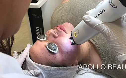 Prijzen fractional laser