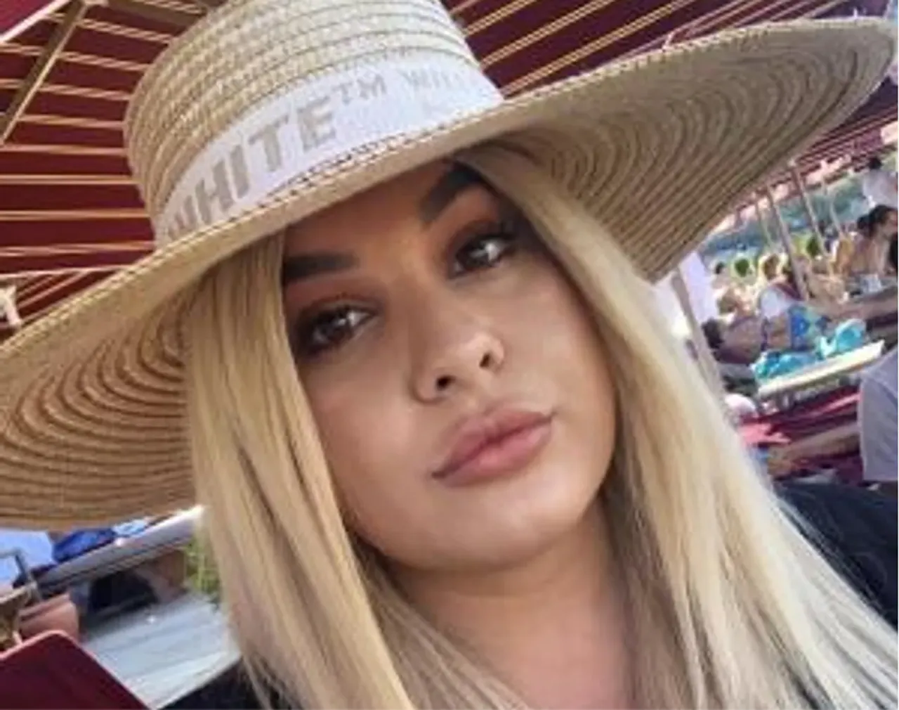 Influencer review na Gentle Max Pro laser behandeling tegen overbeharing