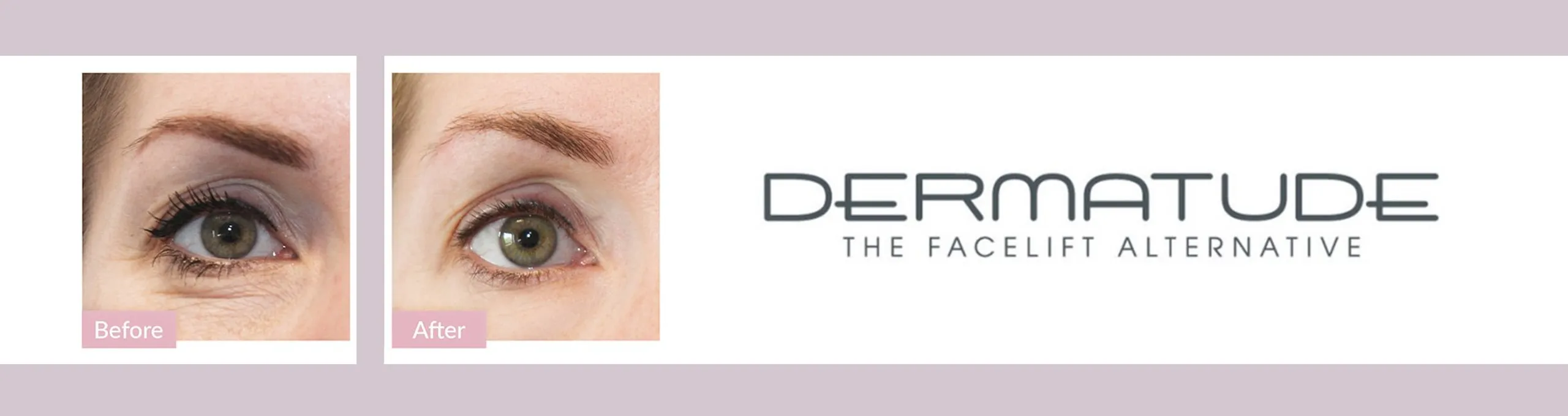 Dermatude Meta Therapie in Rotterdam