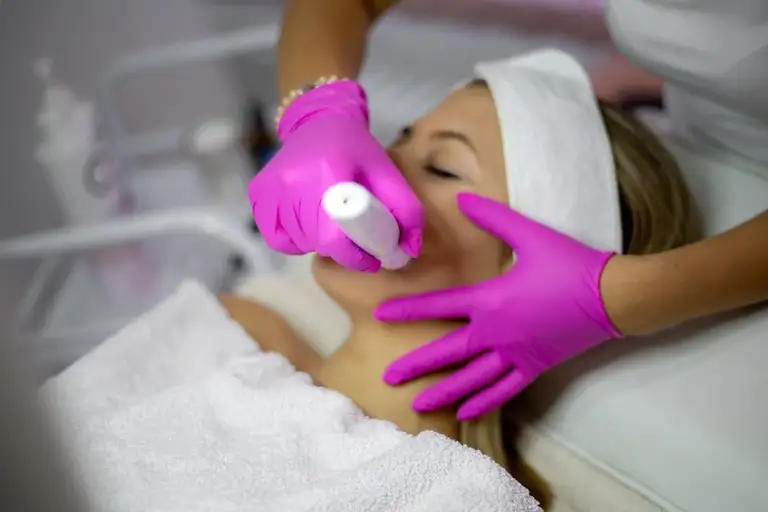 Huidtherapeut voert microneedling behandeling uit bij vrouw, met paarse handschoenen en een Dermapen-apparaat.