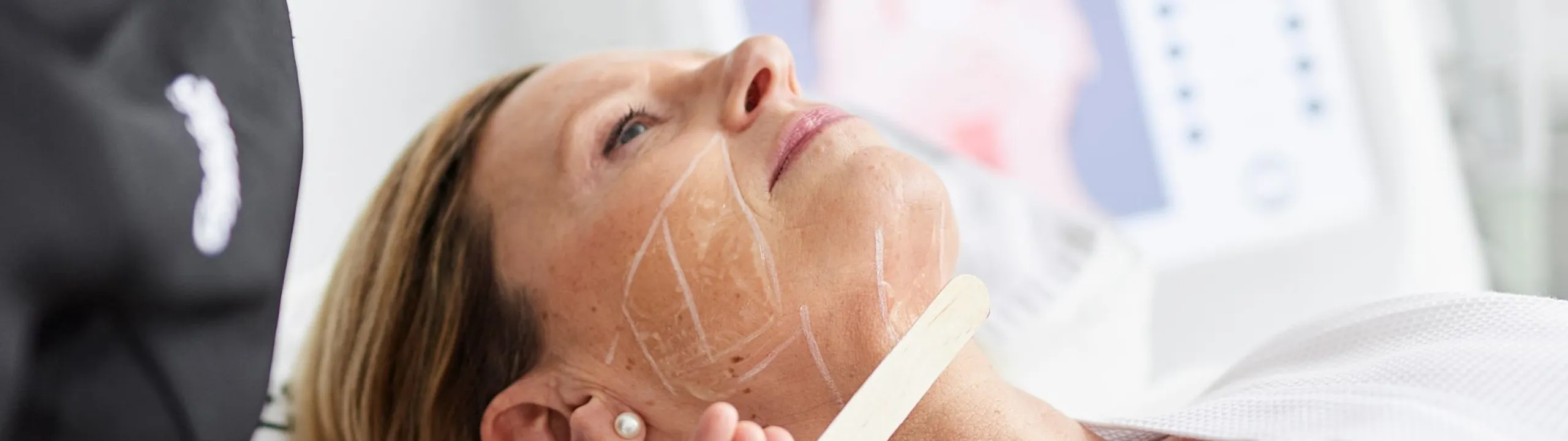 Hifu behandeling bij Apollo Beauty in Rotterdam