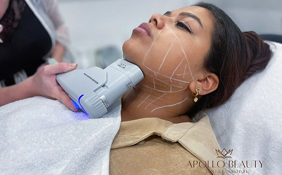 Prijzen HIFU behandeling