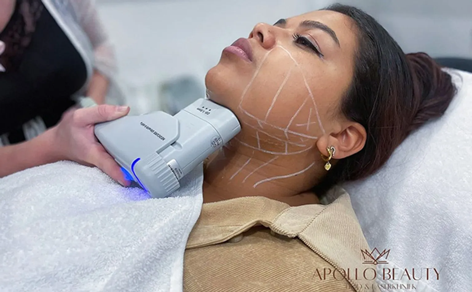 Prijzen HIFU behandeling