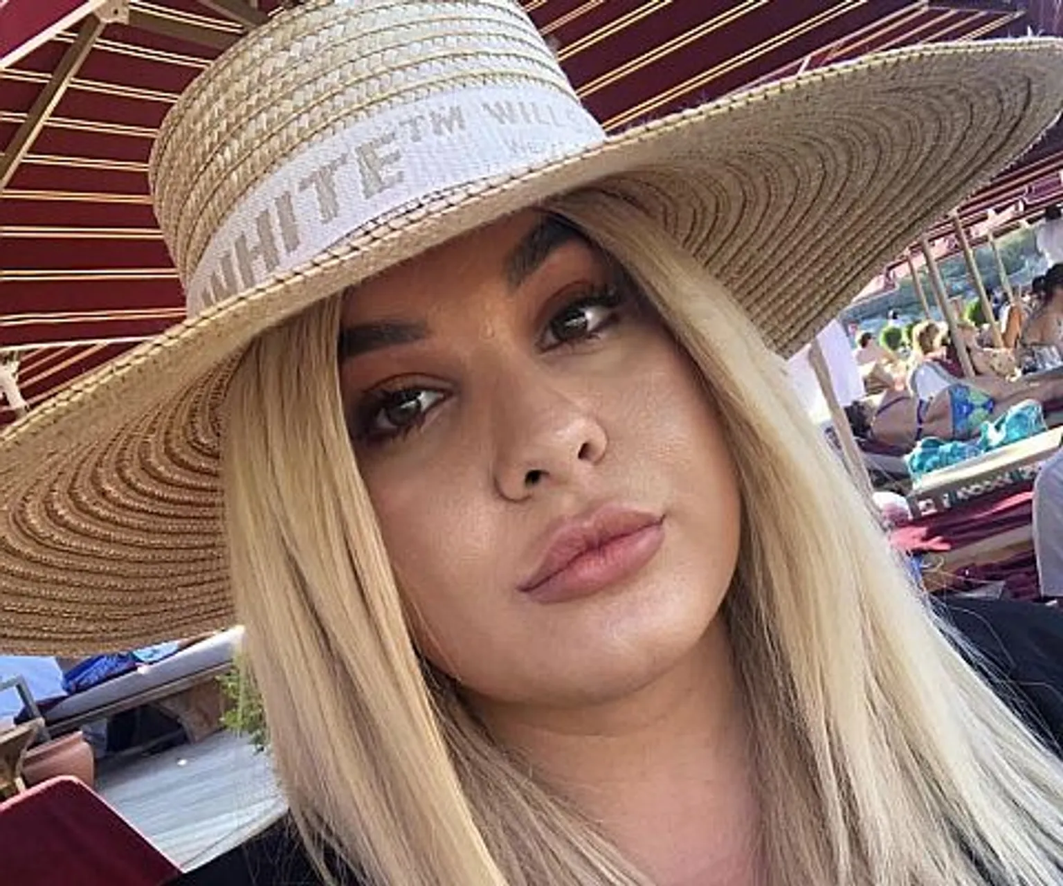 De laserbehandeling tegen overbeharing gaf influencer weer zelfvertrouwen