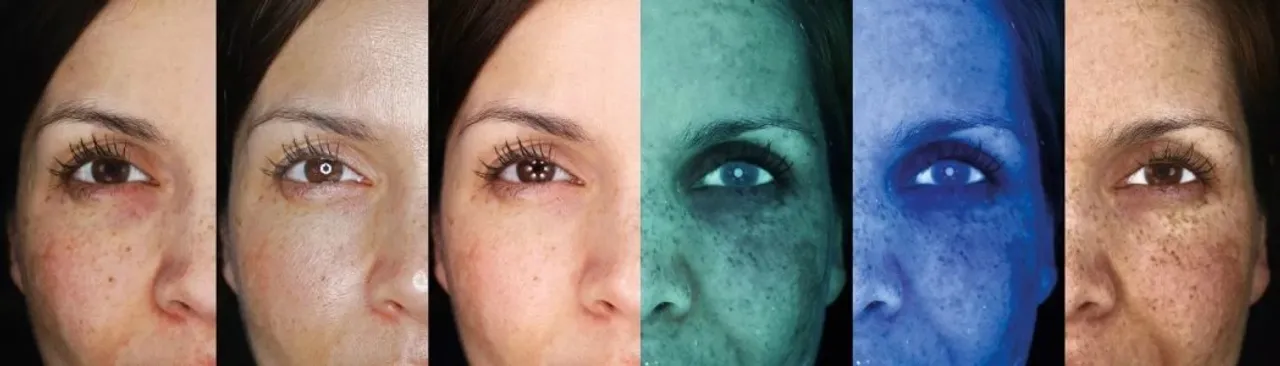 Nobserv 520 Huidscan