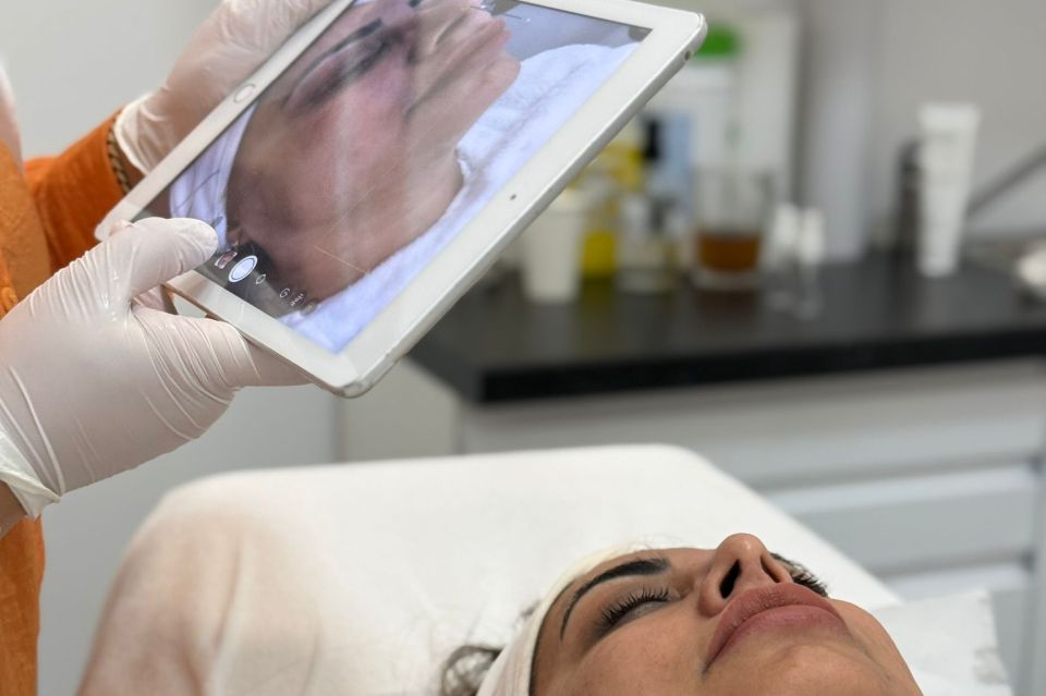 Huidanalyse Apollo Beauty Rotterdam 03 960x640
